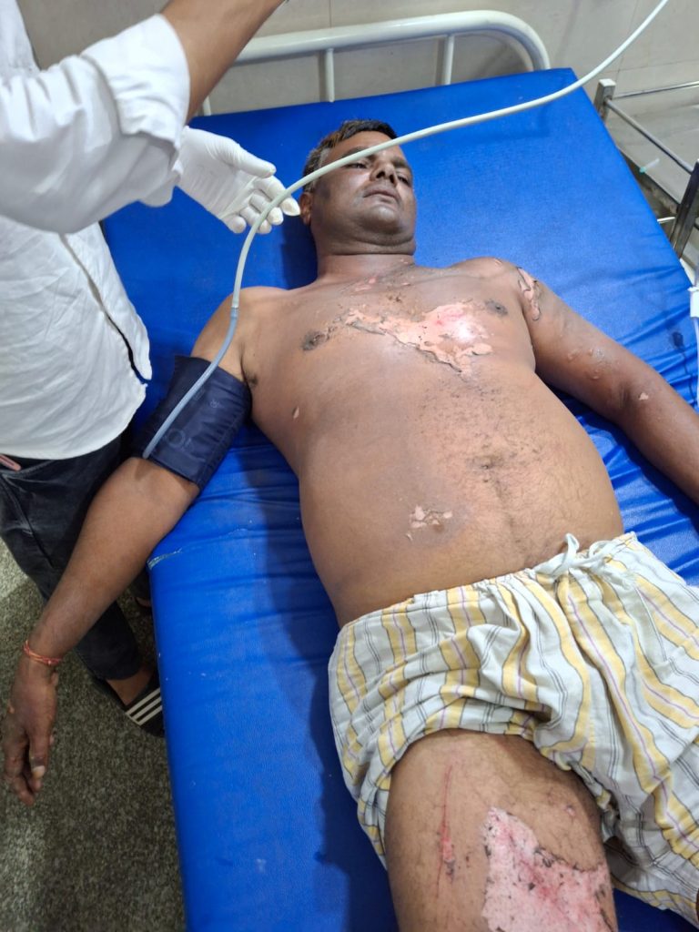 मेरठ: साकेत सिविल लाइन में हादसा, लाइनमैन गंभीर रूप से झुलसा 3 112 55